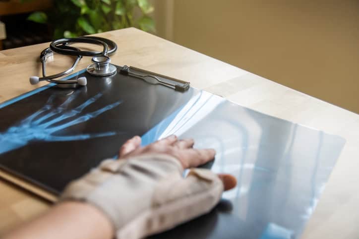 Injured worker xray